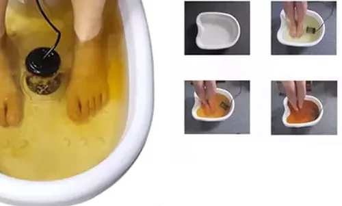 دستگا سم زدایی