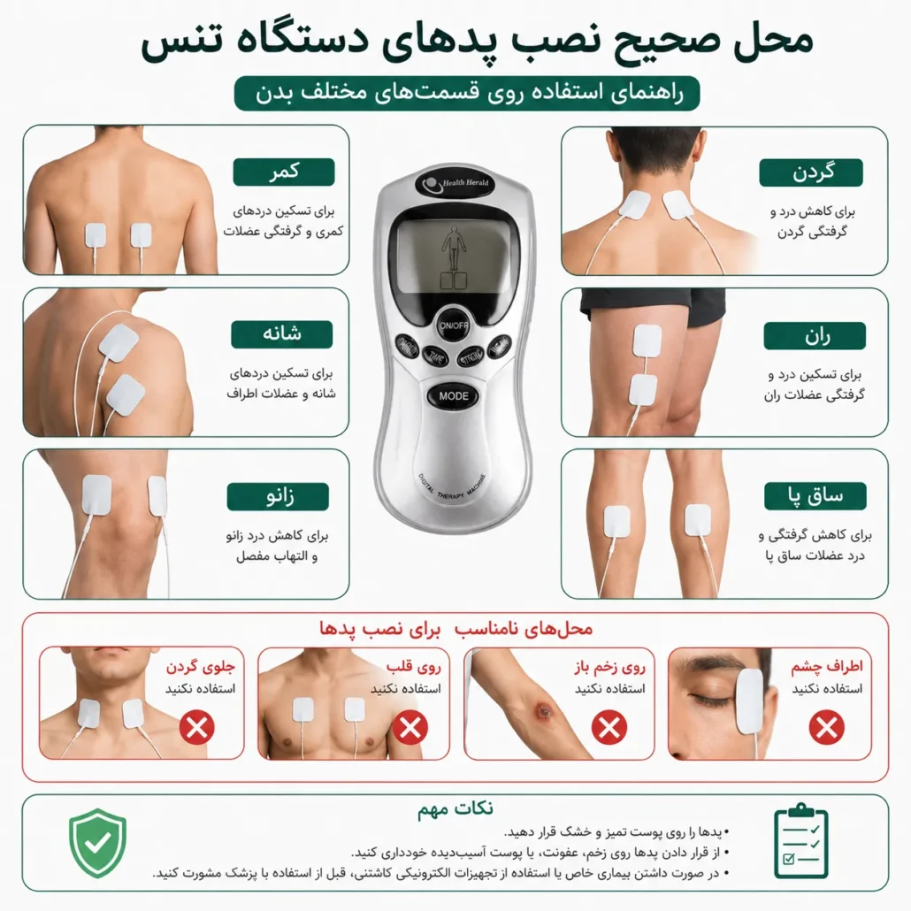 محل صحیح نصب پد دستگاه تنس روی بدن