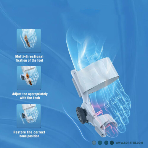 اصلاح کننده هالوکس والگوس پا