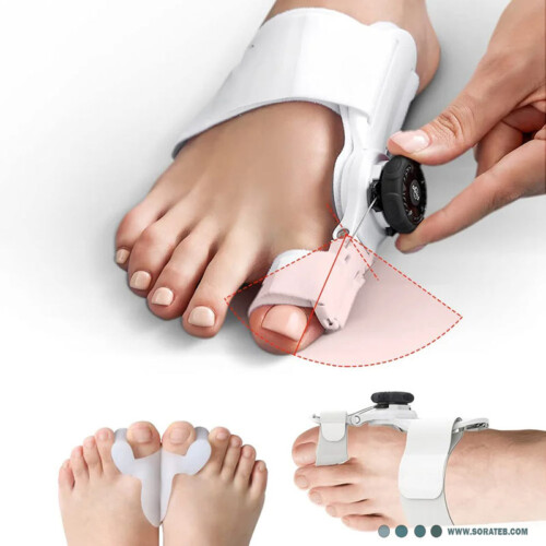 اصلاح کننده هالوکس والگوس پا