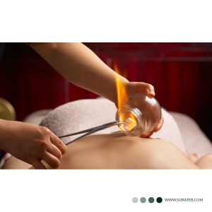 استکان بادکش