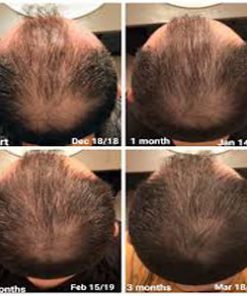 کوکتل مو فیوژن