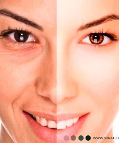 ژل کربوکسی تراپی 1000 میلی ویونسا