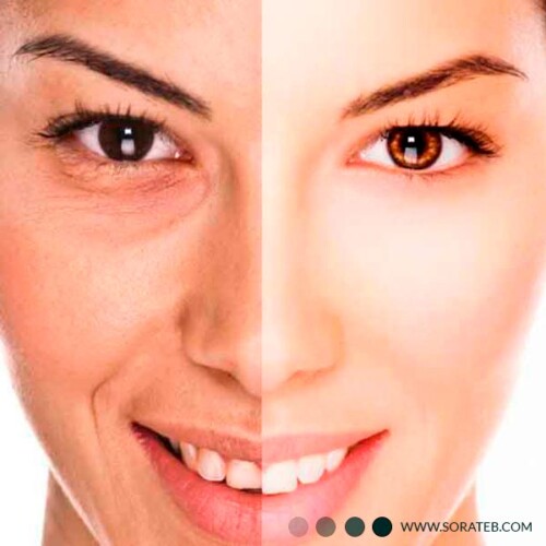 ژل کربوکسی تراپی 1000 میلی ویونسا