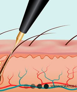دستگاه الکترولایزر استارمکس بیوتی