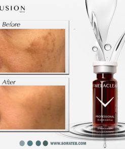 مزوکوکتل رفع لکه فیوژن