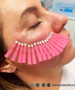 نخ لیفت جوانساز مونو برند NVL