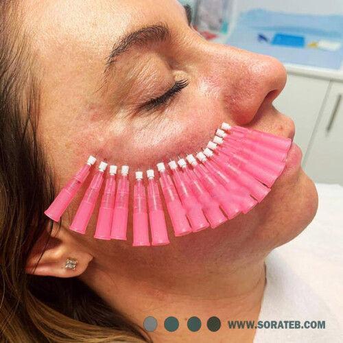 نخ لیفت جوانساز مونو برند NVL