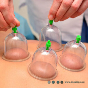 بادکش 6 لیوان RAD MED مدل RM808