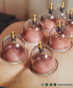 بادکش 6 لیوان RAD MED مدل RM808