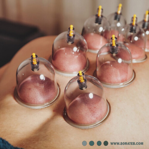 بادکش 6 لیوان RAD MED مدل RM808