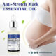 روغن ضد ترک شکم مدل Stretch Marks گوانجینگ 30ml