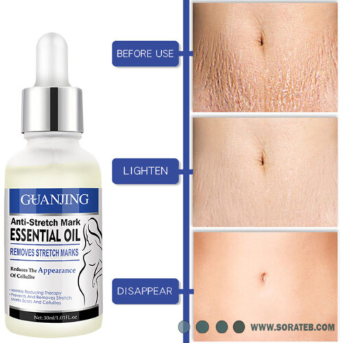 روغن ضد ترک شکم گوانجینگ