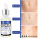 روغن ضد ترک شکم مدل Stretch Marks گوانجینگ 30ml
