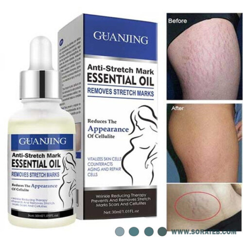 روغن ضد ترک شکم گوانجینگ