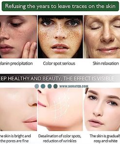 سرم ضد لک و سفید کننده آیچون بیوتی