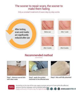 ژل رفع جای آکنه و اسکار Pei Mei TCM