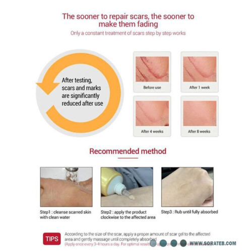 ژل رفع جای آکنه و اسکار Pei Mei  TCM