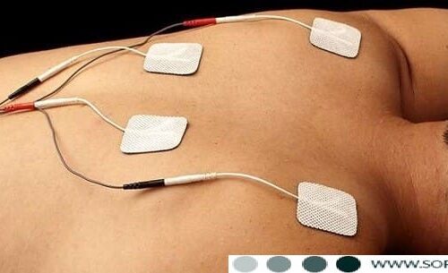 الکترود سیم دار