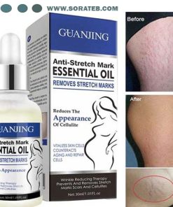 روغن ضد ترک پوست