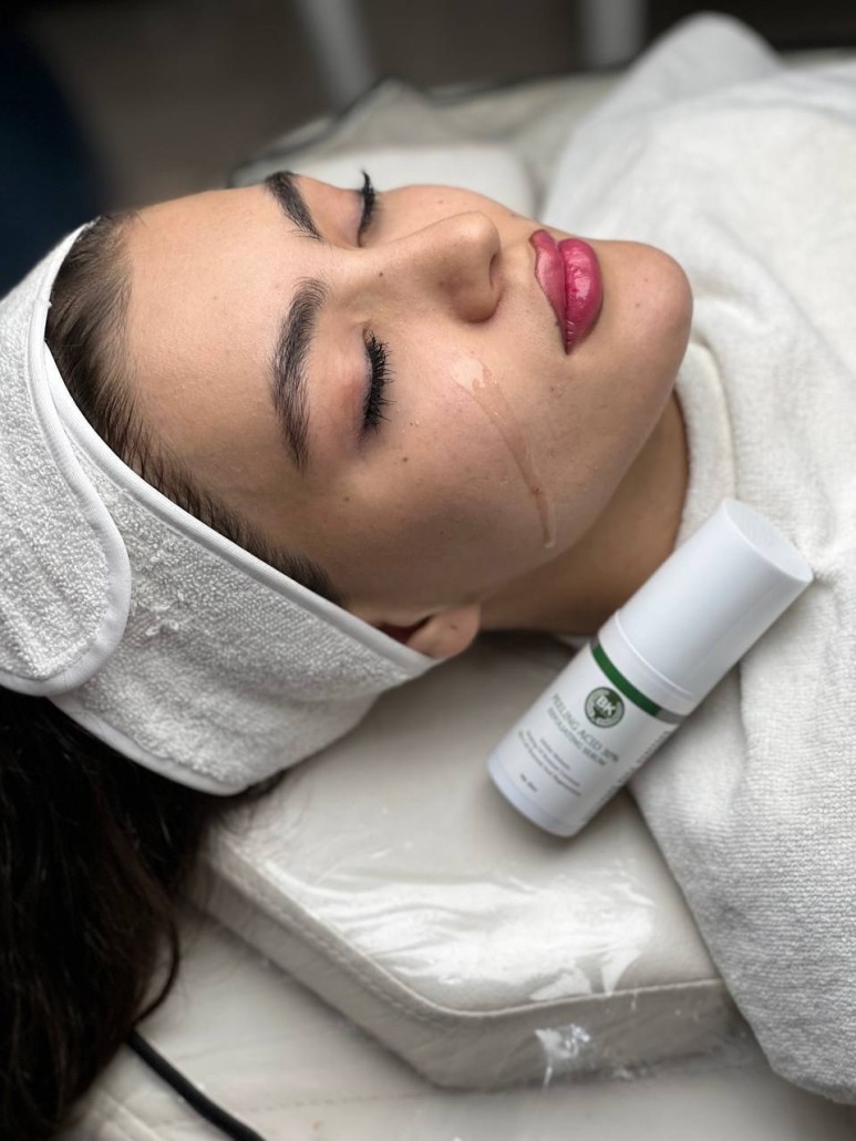 لایه‌بردار اسید میوه بست کلین 