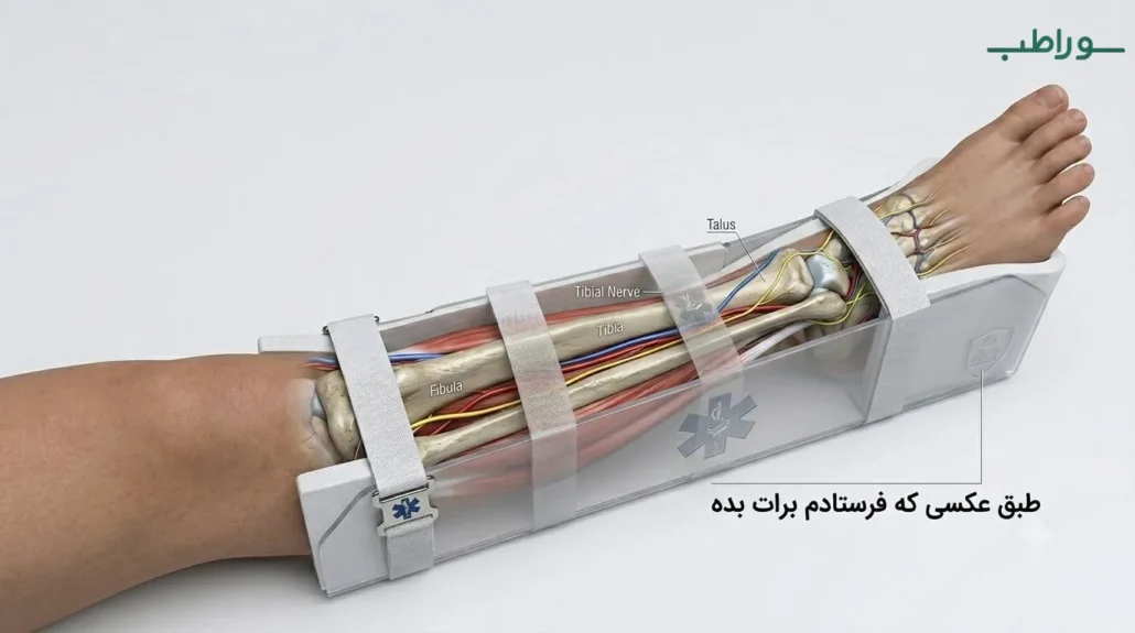 آتل PVC