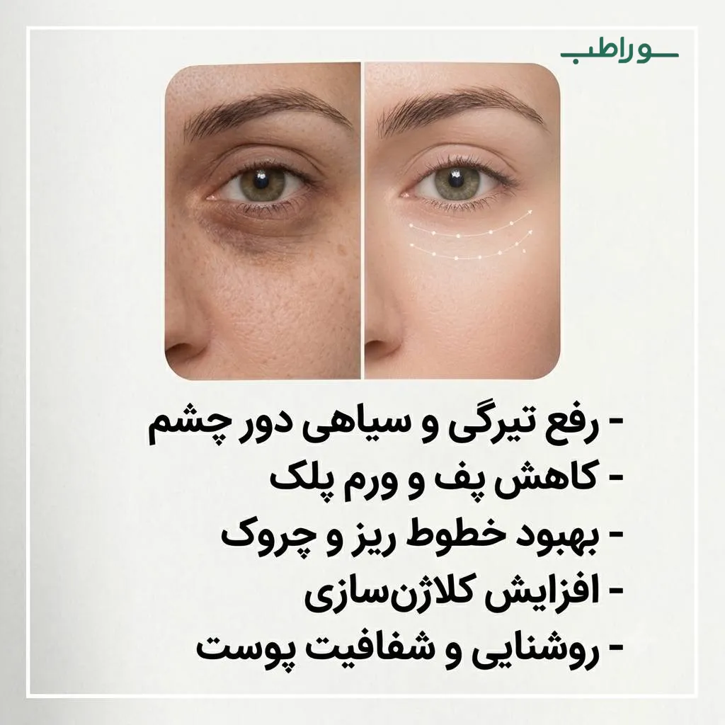 ژل کربوکسی زیر چشم ناچورهکس | کاهش تیرگی و پف دور چشم