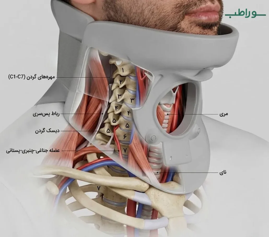 کولار گردنی فیلادلفیا
